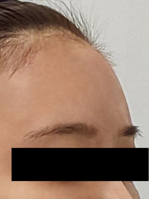After 이미지