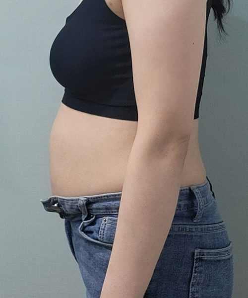 Before 이미지