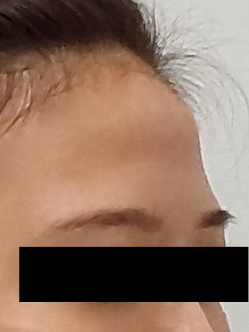 Before 이미지