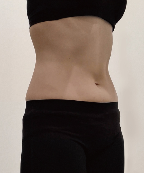 After 이미지