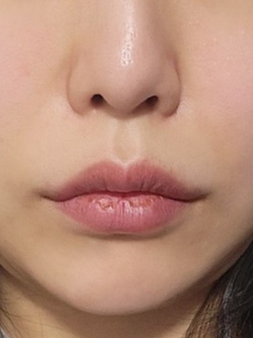 After 이미지