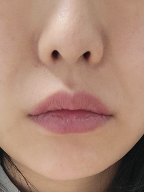 Before 이미지