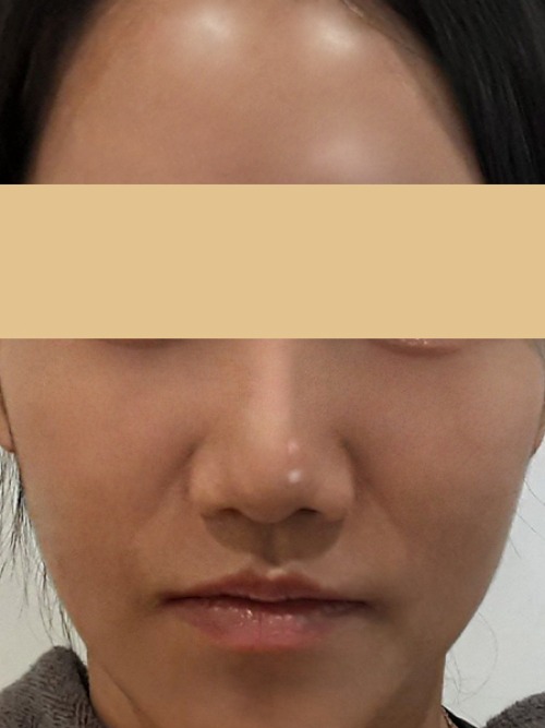 After 이미지