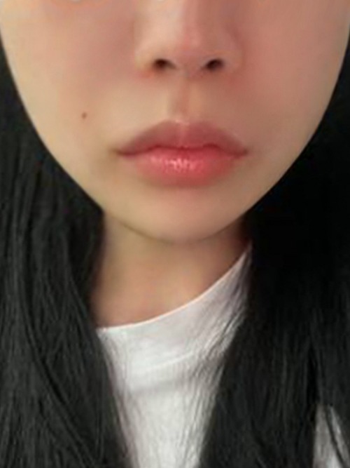 After 이미지