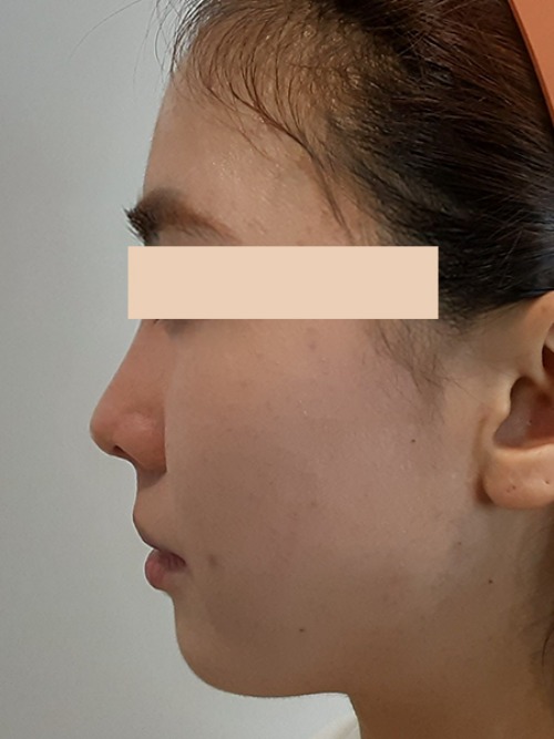 After 이미지