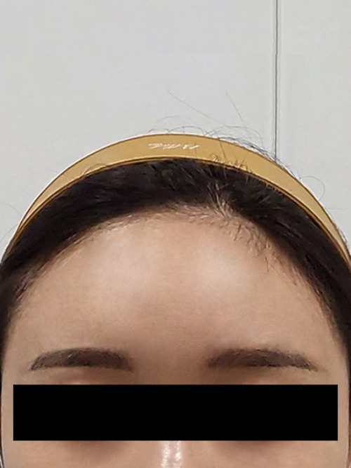 After 이미지