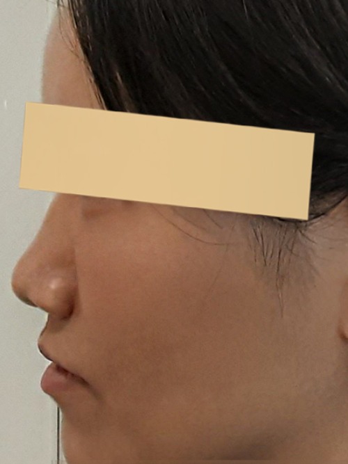 After 이미지