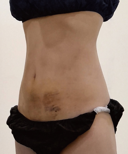 After 이미지