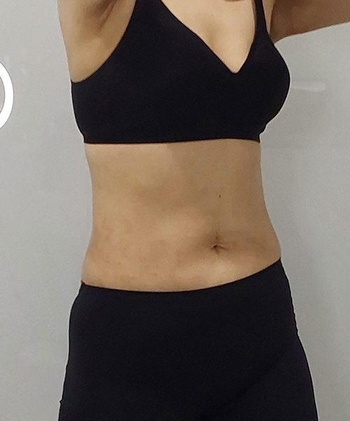 After 이미지