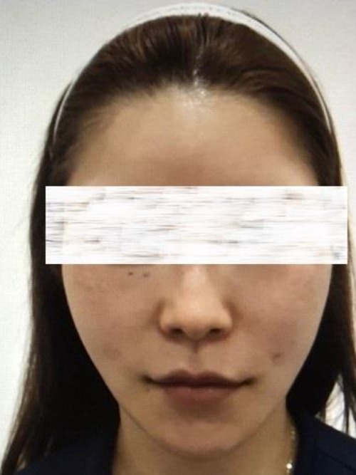 After 이미지