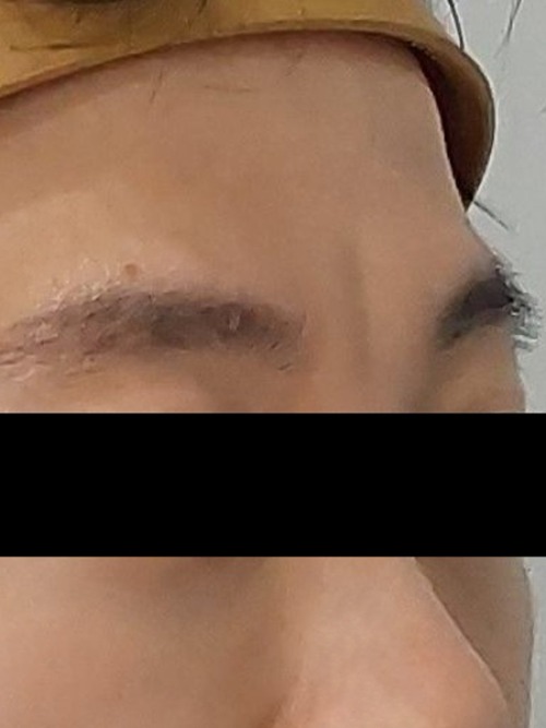 Before 이미지