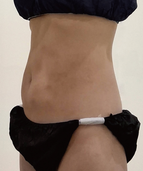 Before 이미지