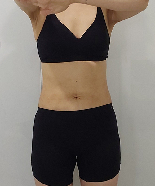 After 이미지