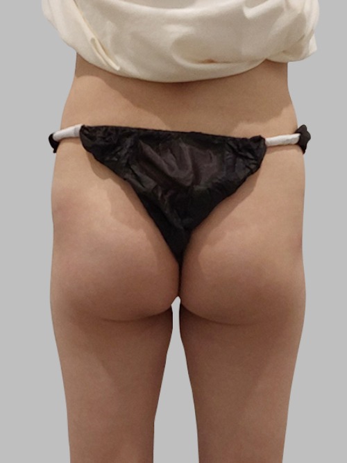 Before 이미지