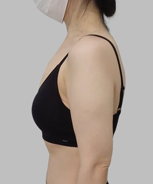 Before 이미지