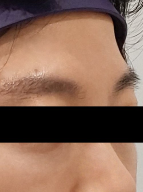 After 이미지