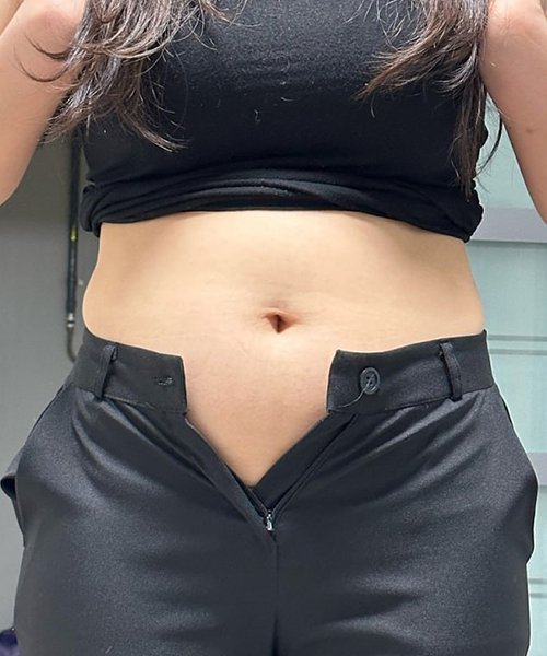Before 이미지
