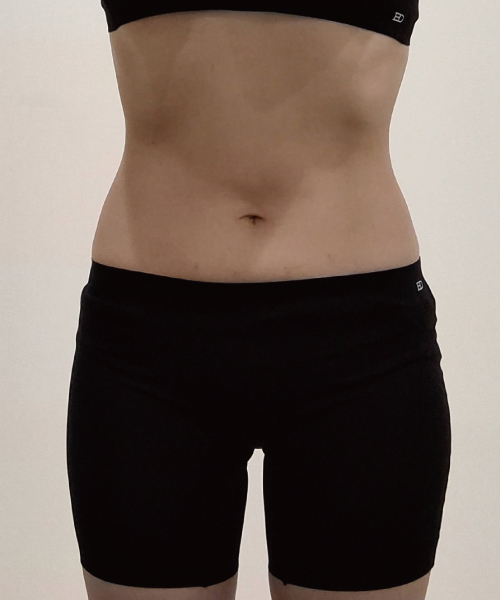 After 이미지
