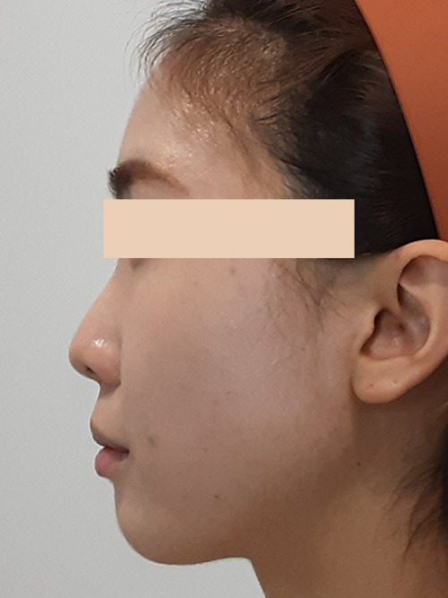 Before 이미지