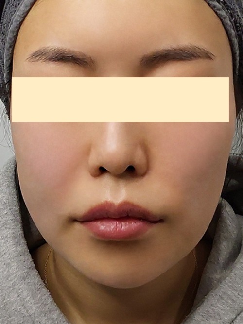 After 이미지