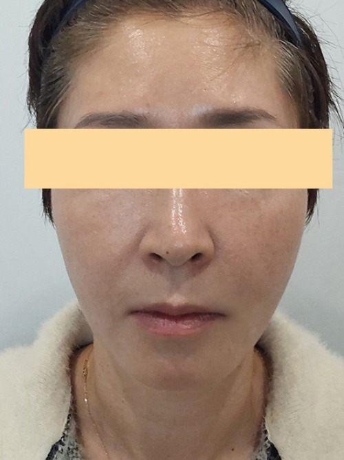 After 이미지