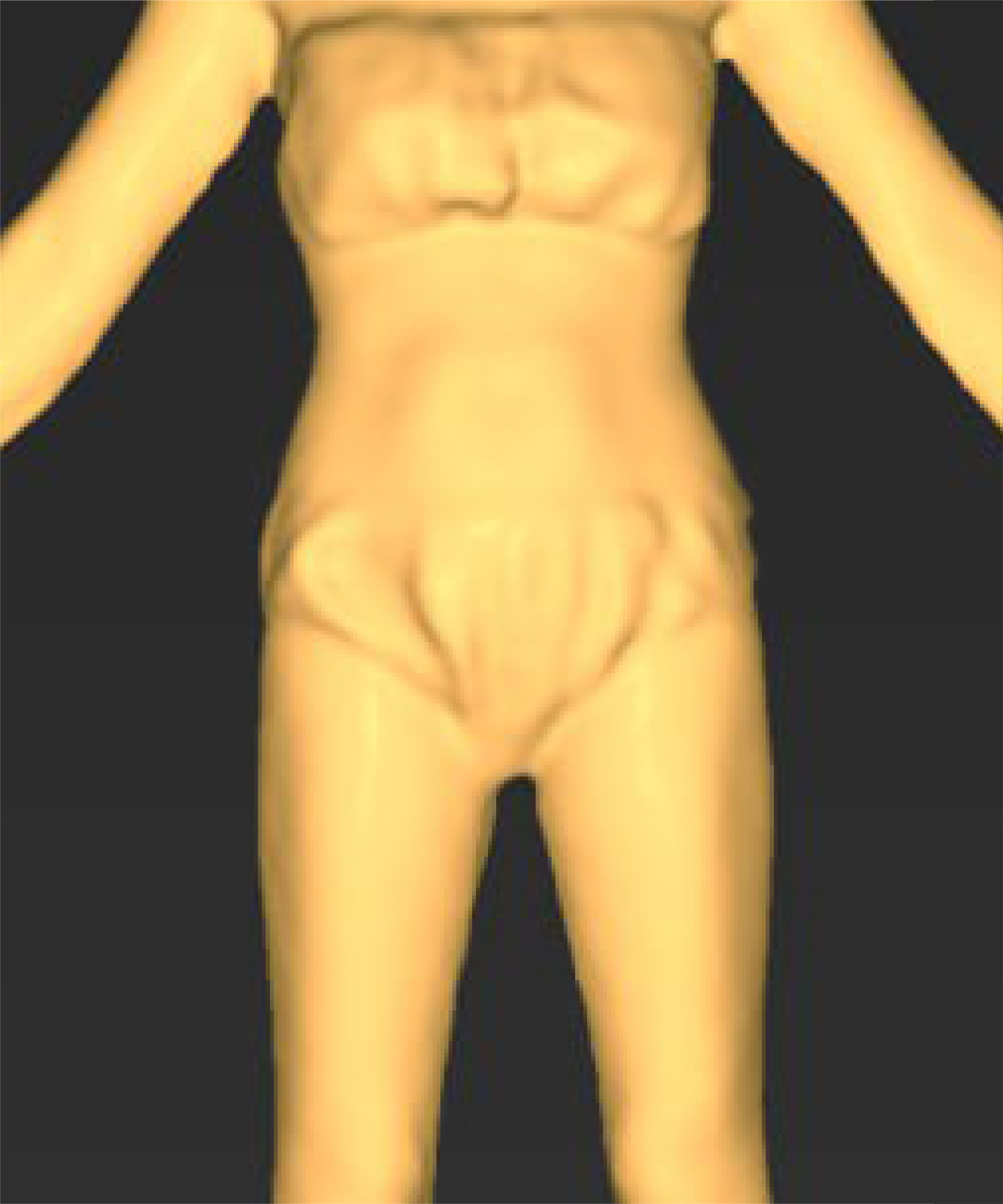 After 이미지