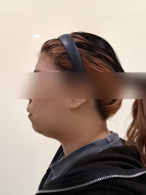 Before 이미지