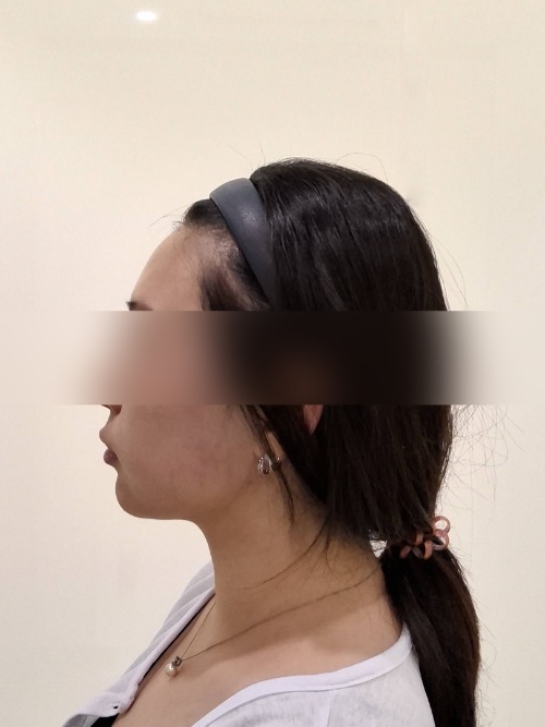 After 이미지