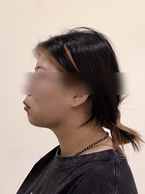 After 이미지
