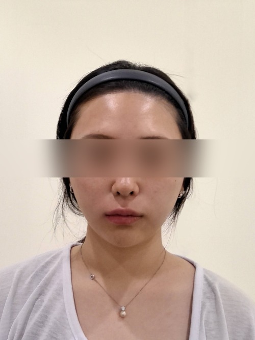 After 이미지