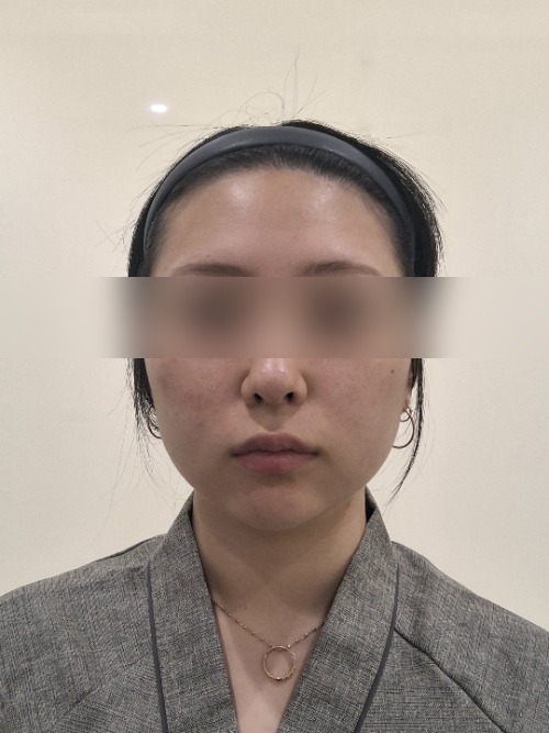 Before 이미지