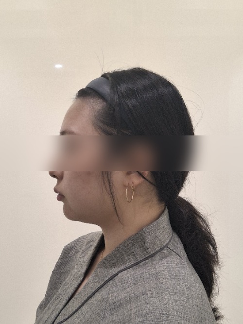 Before 이미지