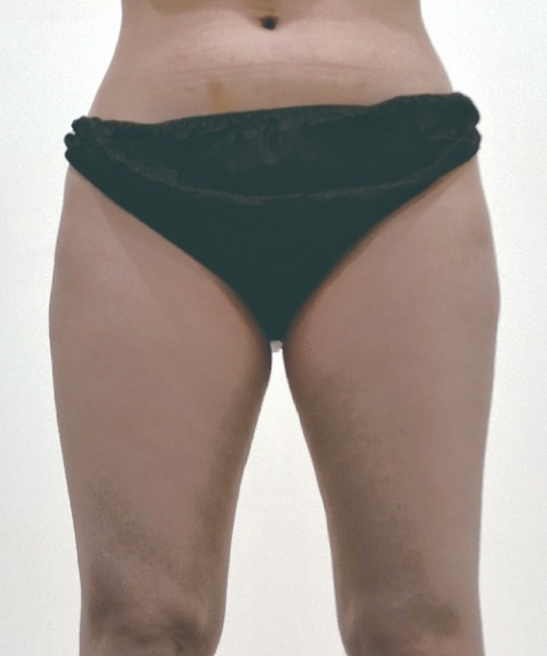 Before 이미지