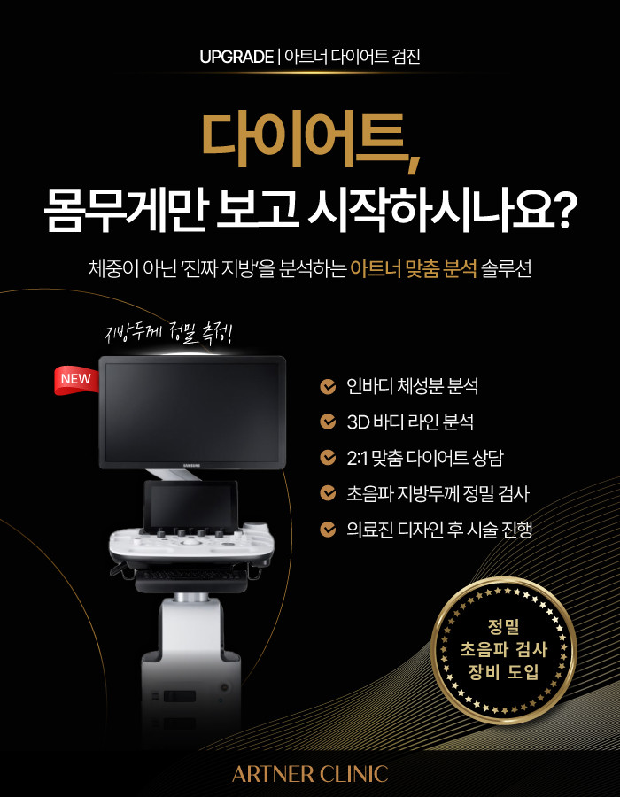 신규 장비 도입