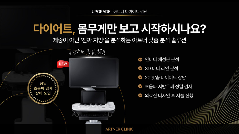 신규 장비 도입